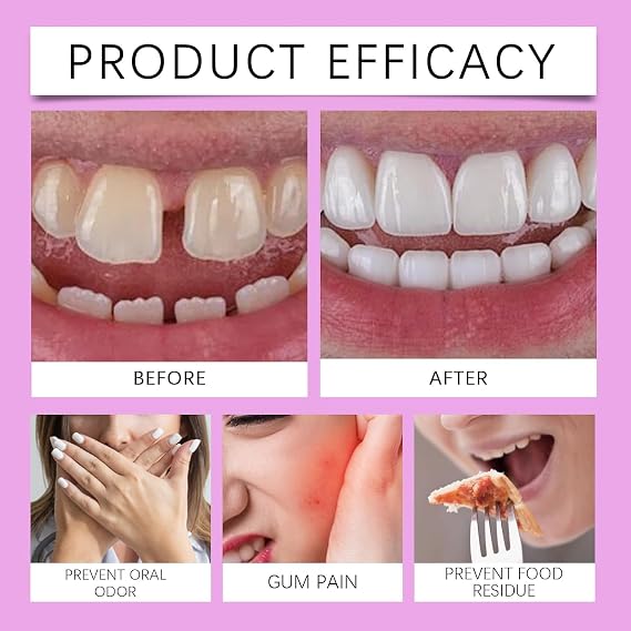 Cvioert Dentures, Cvioert Premium Dentures, Silicone Dentures To Fit Over Existing Teeth, Snap On Veneers Teeth, Premium Dentures Full Set For Men And Women (2pcs)