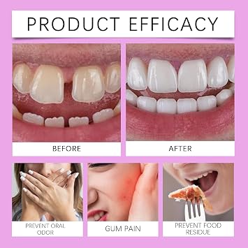 Cvioert Dentures, Cvioert Premium Dentures, Silicone Dentures To Fit Over Existing Teeth, Snap On Veneers Teeth, Premium Dentures Full Set For Men And Women (2pcs)