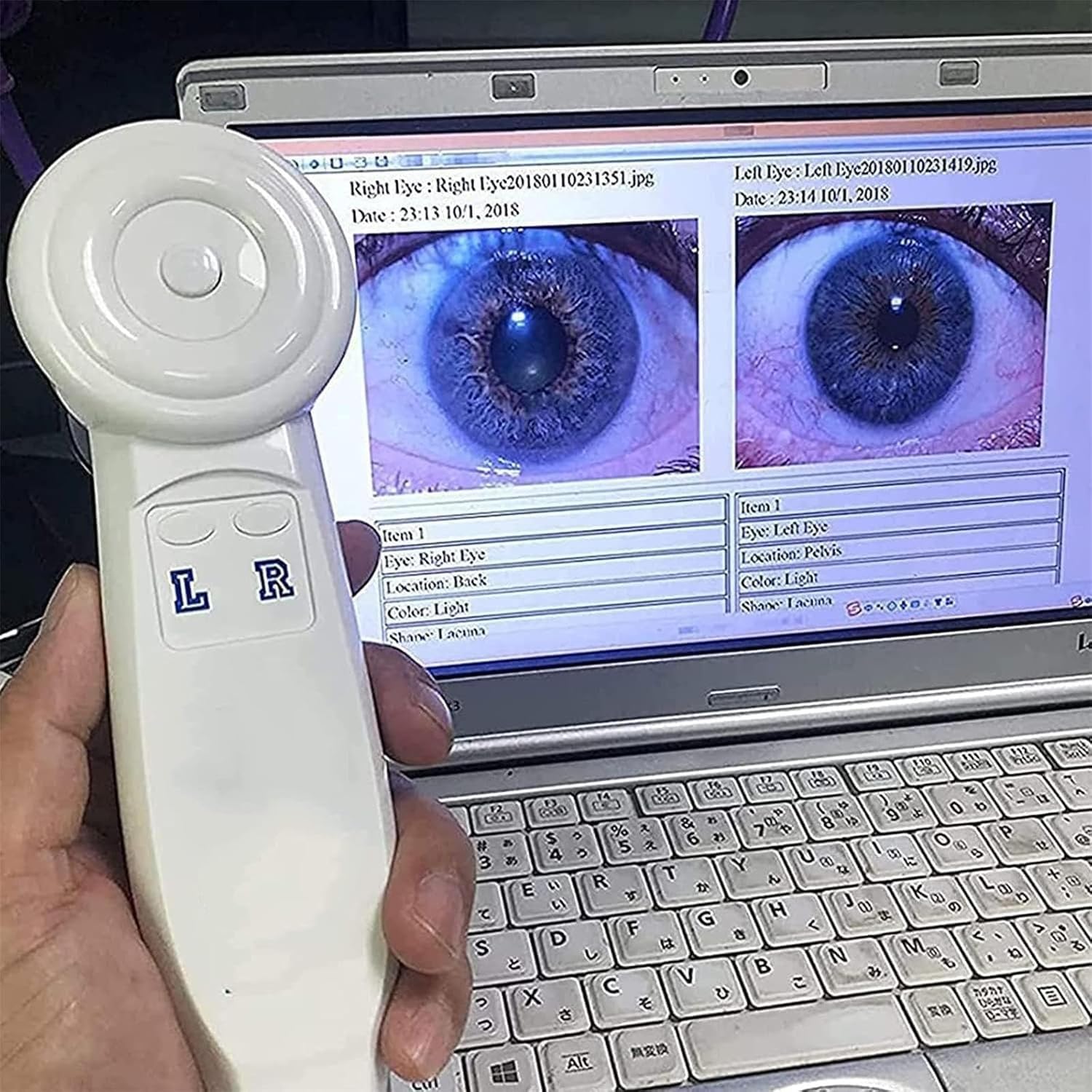 Analizator tęczówki USB Irydoskop, kamera o wysokiej rozdzielczości z obiektywem HD 30x Iris i oprogramowaniem do analizy, precyzyjna kamera irydologiczna do szczegółowego badania wzroku.