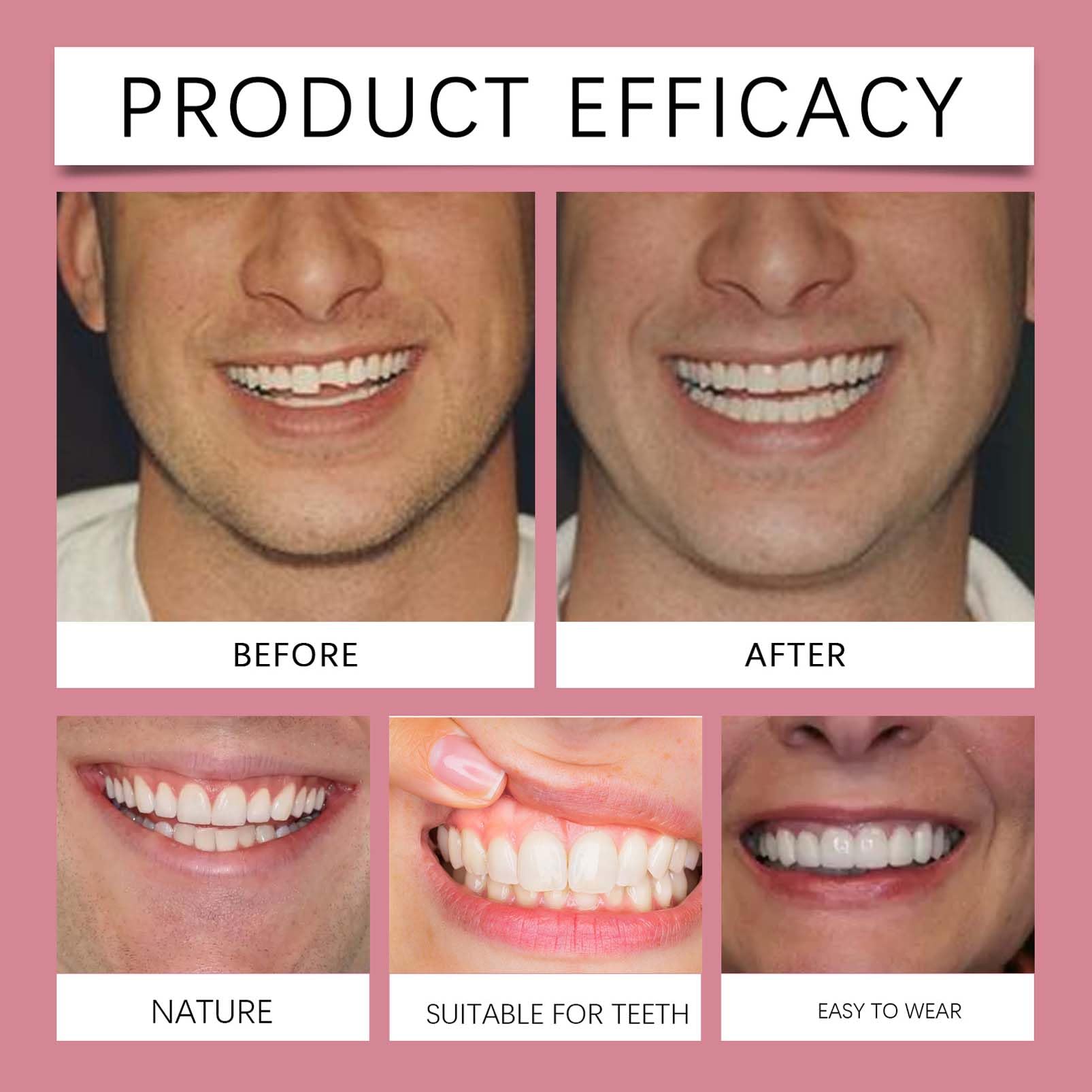 Denture Silicone Reline Kit, zestaw do protez silikonowych, tymczasowe protezy zębowe, tymczasowe zęby