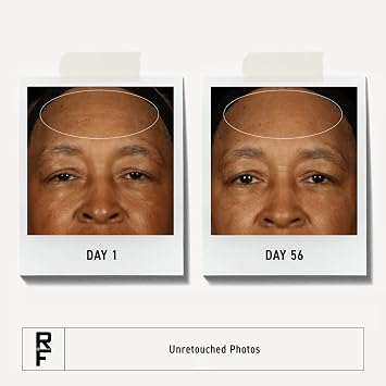 Rodan + Fields Redefine Regimen | Skincare Kit Includes Clay Cleanser, Toner, Triple Defense Cream, Overnight Cream | Skin Care Gift Set for Women