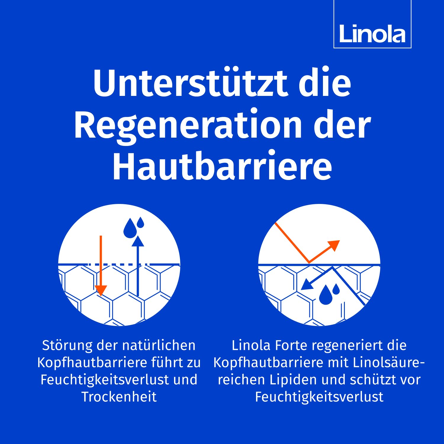 Linola Forte Kopfhaut-Tonikum - 2 x 100 ml | Kopfhautpflege bei juckender, trockener und schuppiger Kopfhaut | Lindert Juckreiz und leichte Entzündungen | auch bei Neigung zu Neurodermitis geeignet