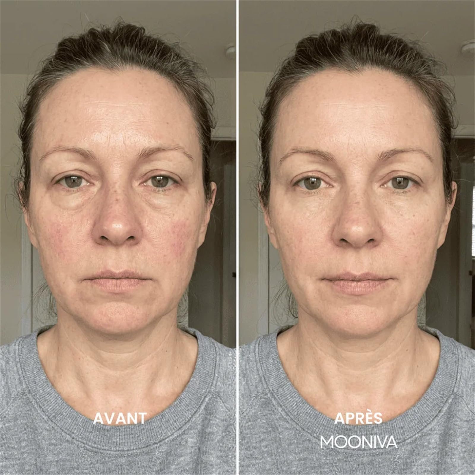 Mooniva LunaSculpt - Brosse Lymphatique Visage brosse contour visage brossage à sec drainage lymphatique forme ergonomique pour visage menton mâchoire contact précis peau