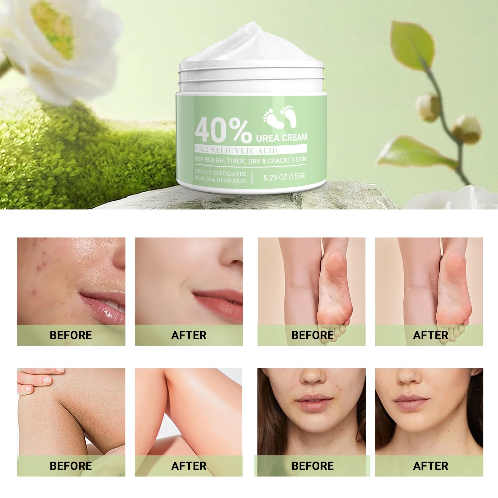 Crema Urea al 40%, Crema Piedi Secchi Sscrepolati, con Acido Ssalicilico al 2% e Aloe Vera per Un'idratazione Profonda, per Piedi, Mani, Talloni, Gomiti, Unghie e Ginocchia