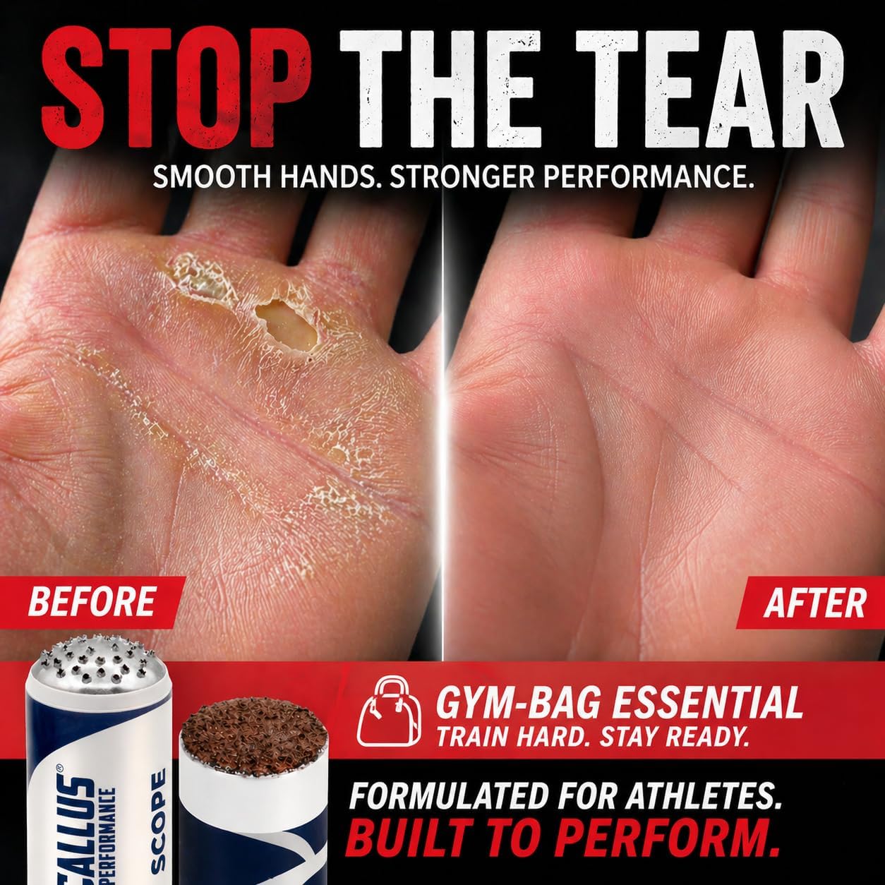 Hand Callus Shaver & 2 Smoothers | Precision Removal Tool for Weightlifters & Functional Fitness | Safe Alternative to Razors | Prevent Rips