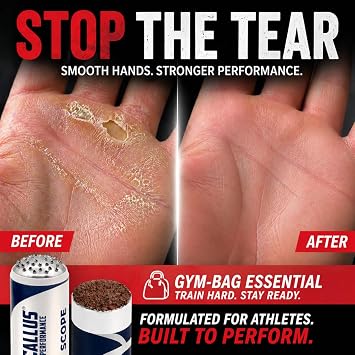 Score Hand Callus Shaver & Smoothing File for Athletes & Working Hands | Prevent Rips & Tears | Precision Scraper for Weightlifting, Cross Fitness, Gymnastics & Rowing