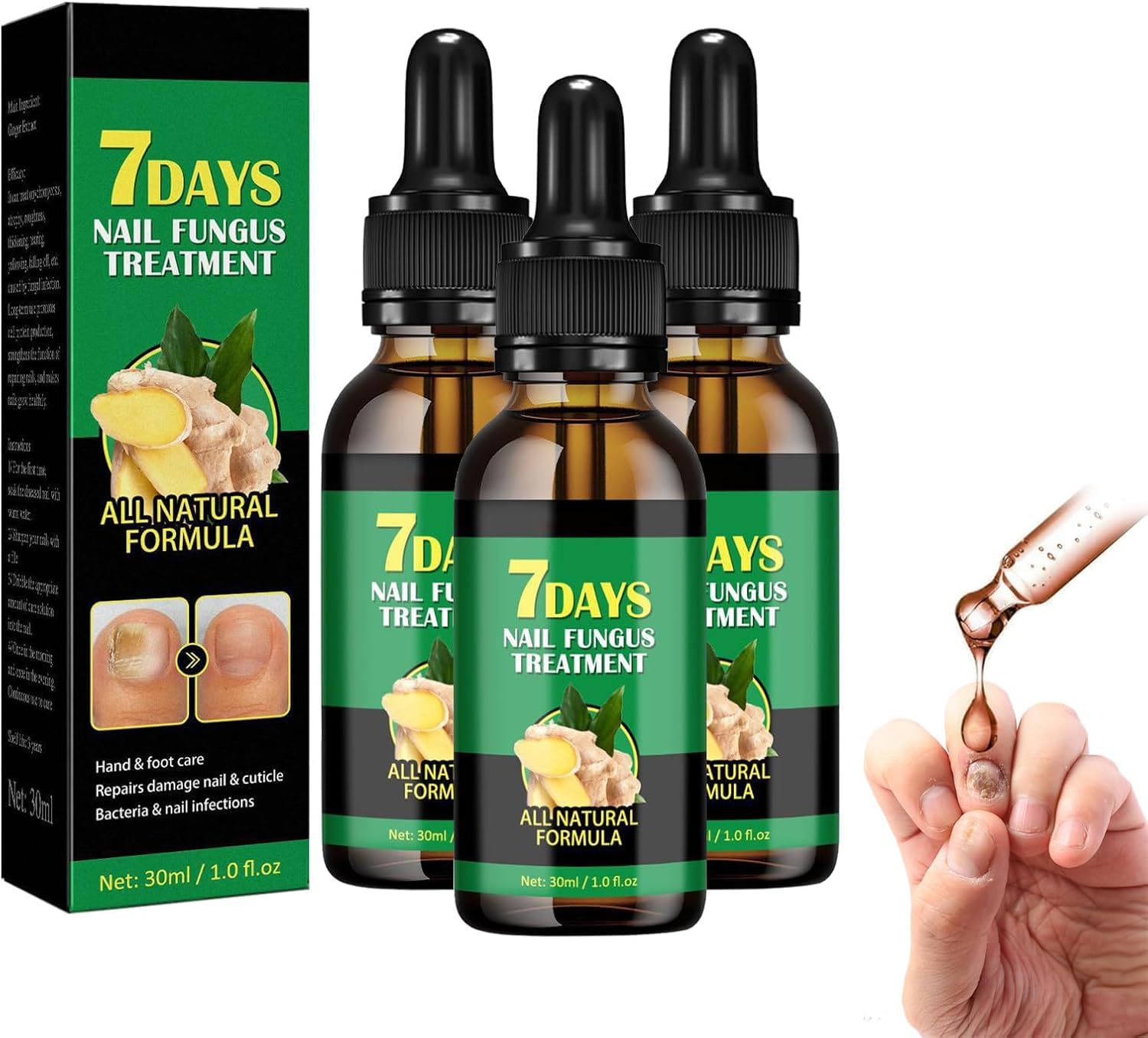 Ginger Nail Treatment Nail Support Nail Care, 7 Days Nail Treatment,Ginger Nail Growth Serum, Ginger Nail Treatment, Ginger Cuticle Care Oil for Damaged Nails (3pcs, 30ml)