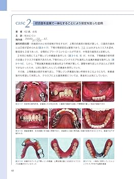 長期症例に学ぶパーシャルデンチャー 長期症例に学ぶパーシャルデンチャー - クインテッセンス出版