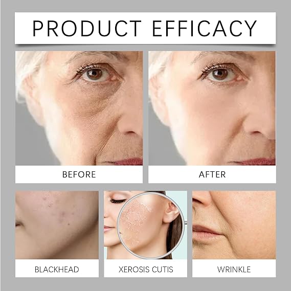 Spot Remover For Face Serum,Dark Spot Corrector Cream,Sun Spots and Melasma Freckle Remover,Spot Remover For Face Serum,Sun Spots and Melasma Treatment Cream for Face 50G