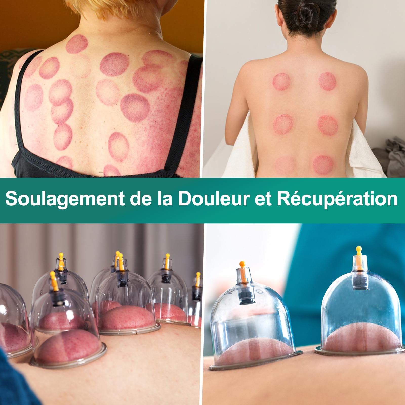 Kit de 20 Cupping Ventouses Hijama, Ventouses Thérapeutiques Chinoises avec Pistolet Massage Acupuncture