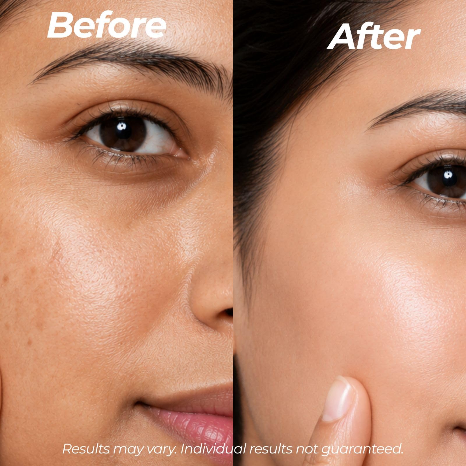 glutathione with vitamin c before and after Velleja 10% + Face Serum for Dark Spots & Pigmentation | 5% Niacinamide + 2% Alpha Arbutin | Brightening & Hydrating Glow Serum | For Men & Women tighten skin Color:6 B12 Injections