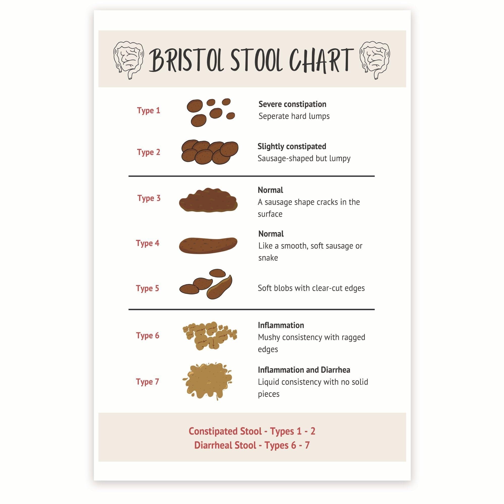 RNUMLIGH Bristol Stool Chart Poster, Stool Types & Digestive Health Guide, Educational Chart for Doctor Clinic Office(Unframed,12x18inch(30x45cm))