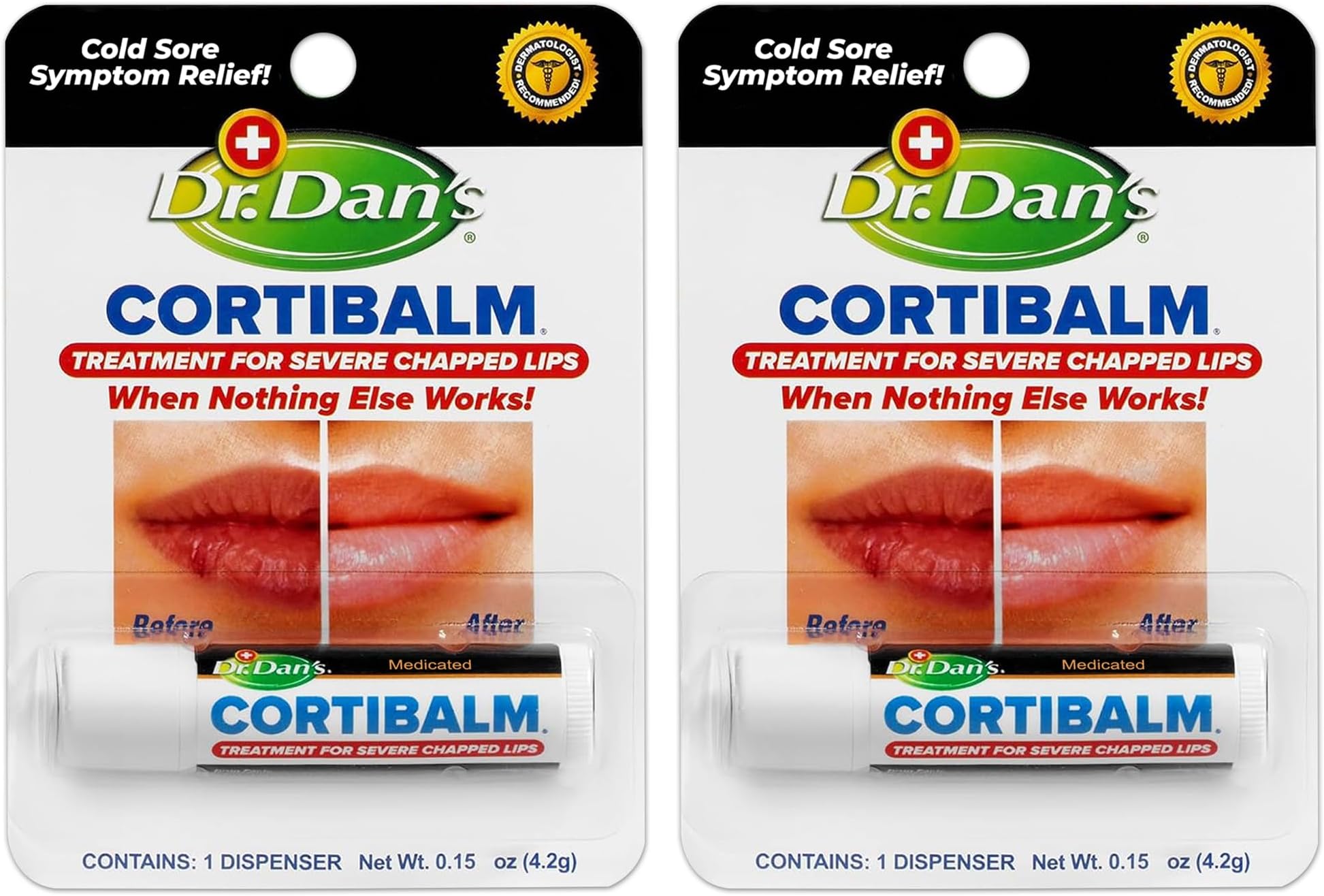Dr. Dan's Cortibalm- 2 Pack- for Severe Chapped Lips and Cold Sore Relief