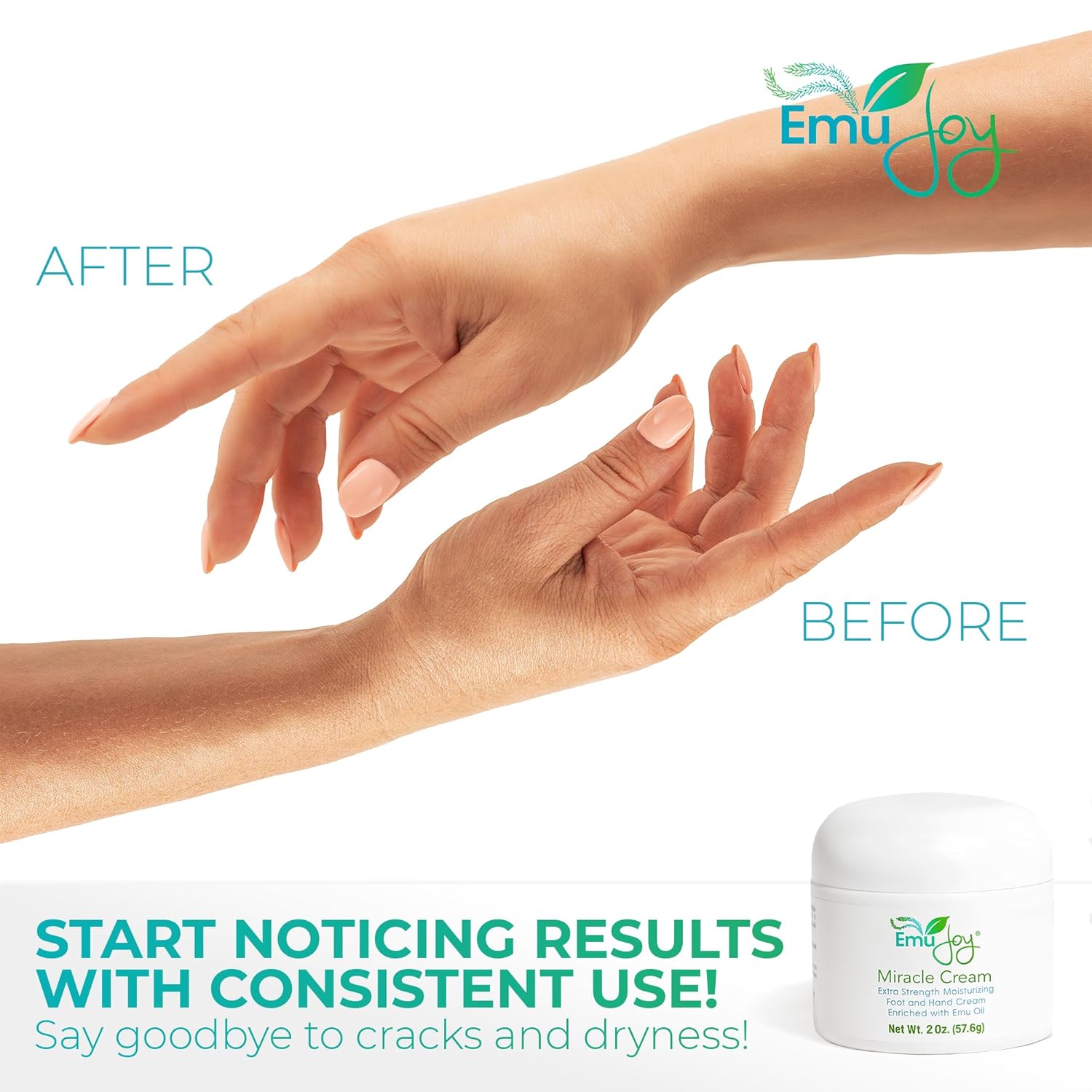 Emu Joy Miracle Cream - Extra Strength Hand & Foot Cream for Cracked Heels, Dry Skin & Calluses - Lanolin, Beeswax & Emu Oil Formula - For Hands, Feet, Elbows & Knees - 2 oz