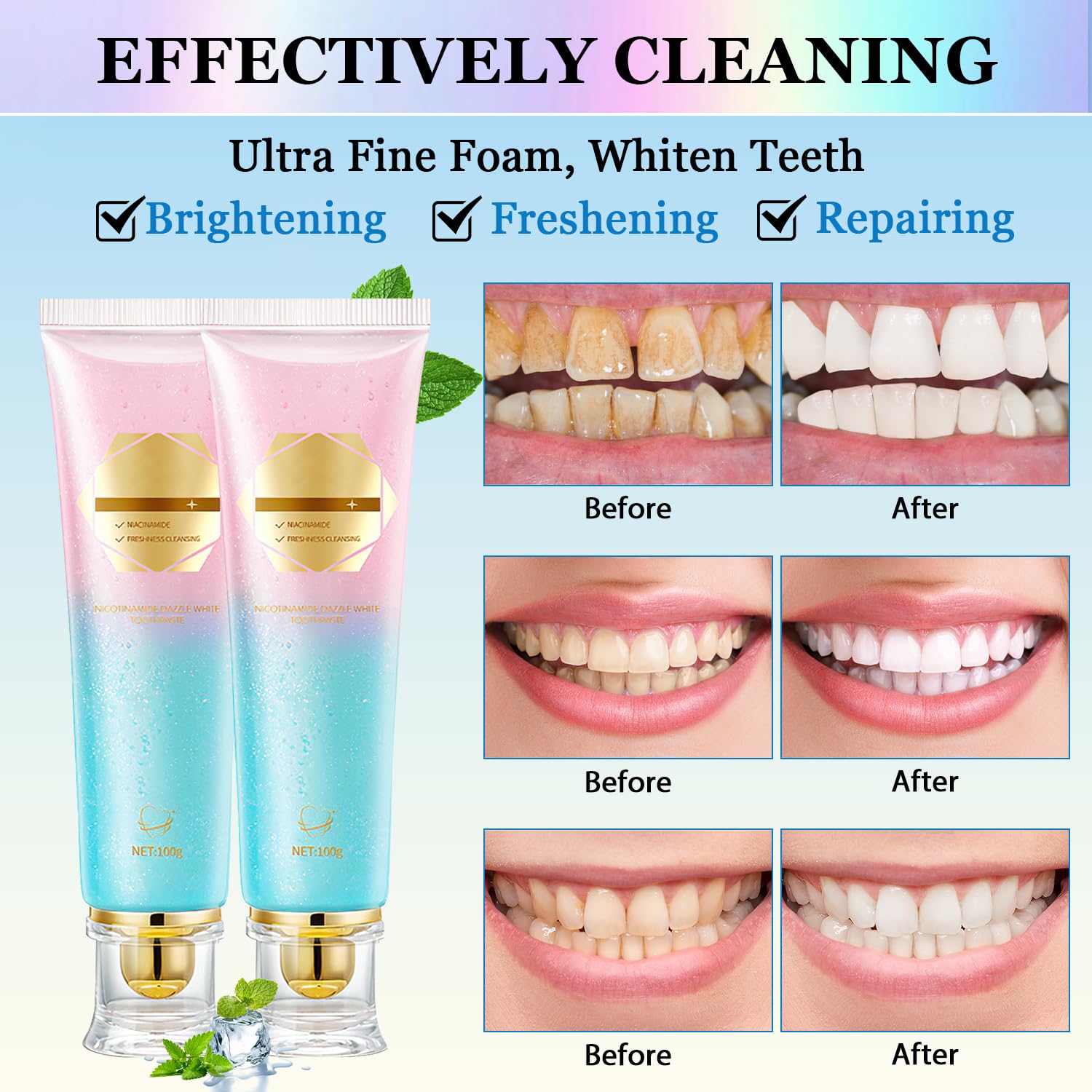 2Pcs Acssart Radiant Niacinamide Intensive Whitening Toothpaste, Niacinamide White Toothpastes, Remove Tooth Stains, Fresh Breath