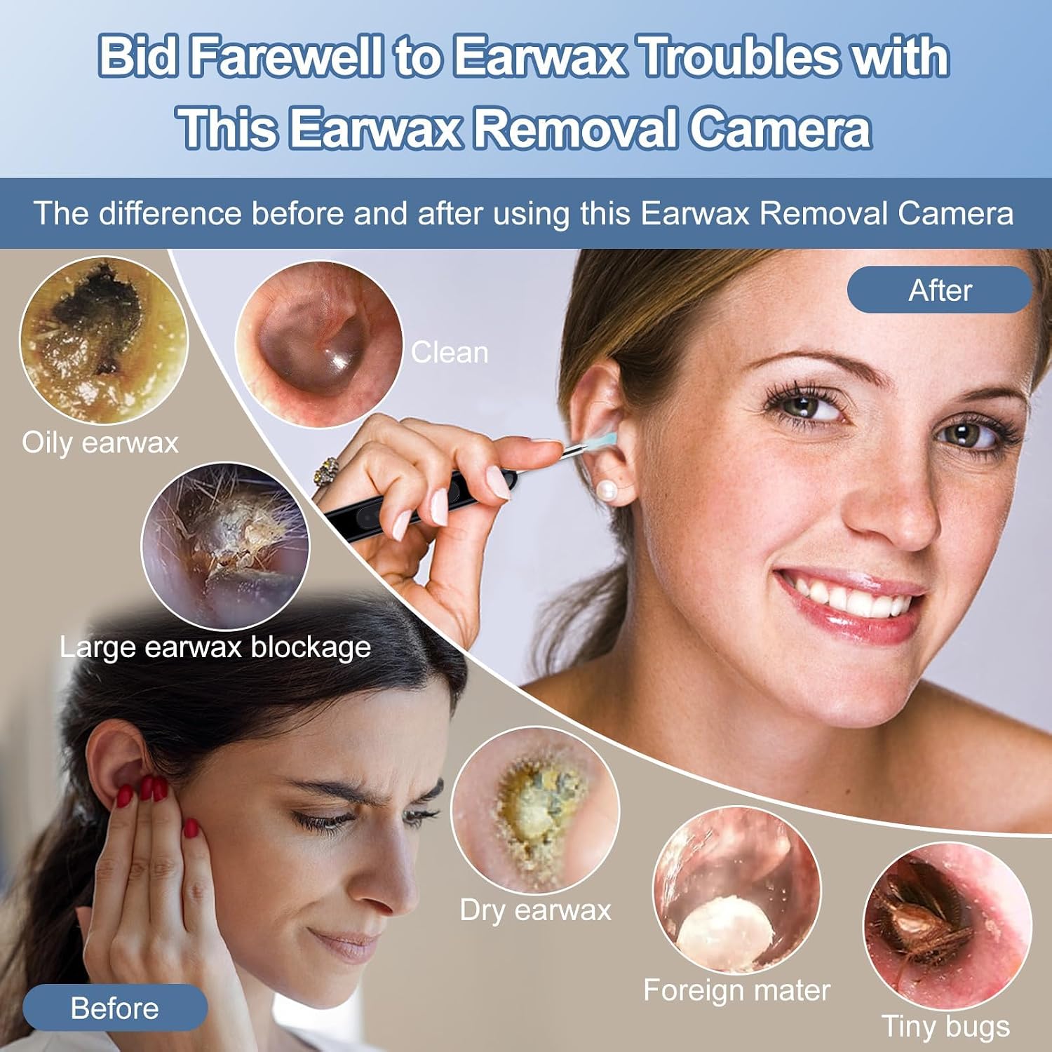 Ear Wax Removal, Ear Wax Removal Kit Tools with 6 LED Lights/IP67 Waterproof Lens/8 Traditional, Ear Cleaner with Camera 1080P HD USB Rechargeable Ear Picker Cleaning kit Black image 2