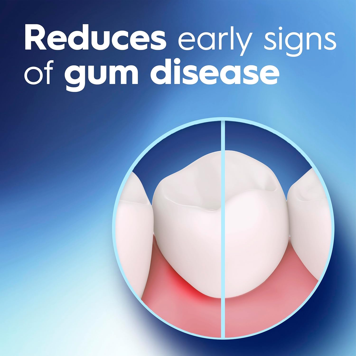 Crest Pro-Health Gum Care Mouthwash, Cool Wintergreen, CPC Antigingivitis/Antiplaque Oral Rinse 1L (33.8 fl oz), Pack of 2, Alcohol Free for Adults - Image 4