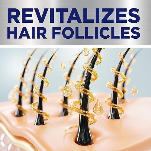 Miniatura 7 de GoodSense Minoxidil Solución tópica USP, 5 por ciento, tratamiento de crecimiento del cabello para hombres, extra fuerte 6 onzas líquidas (paquete