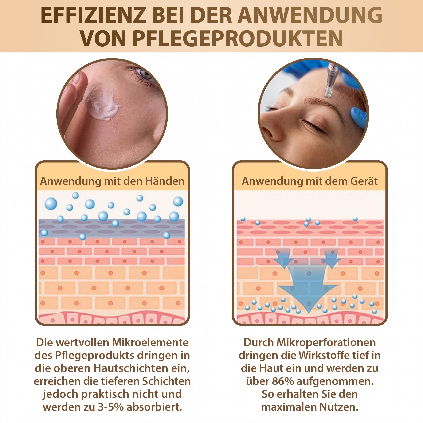 P-Beauty Ersatz Nadeln Patronen mit Bajonettverschluss 36 Pin 50 Stück - Ersatznadeln Dermapen kompatibel mit A6 A10 M5 M7 N2 Geräten - Microneedling Pen, Derma Pen für großflächige Anwendungen