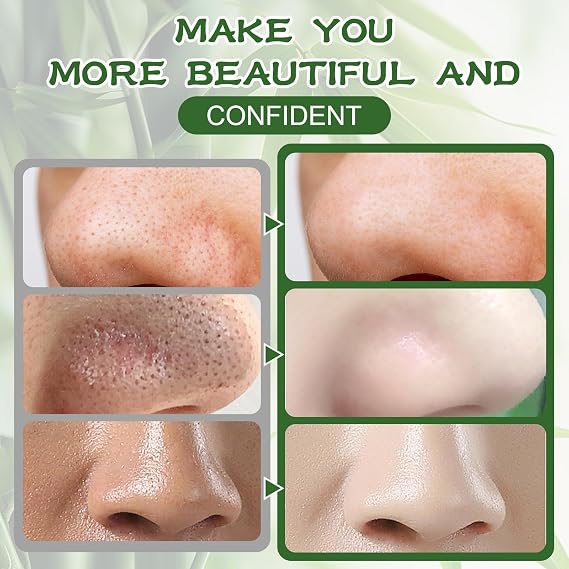 Blackhead Remover Strips,80 Pcs Charcoa Pore Strips Deep Cleansing Nose Strip Blackhead Face Blackhead Remover Suitable for All Skin Types Effective for Men and Women(Black)