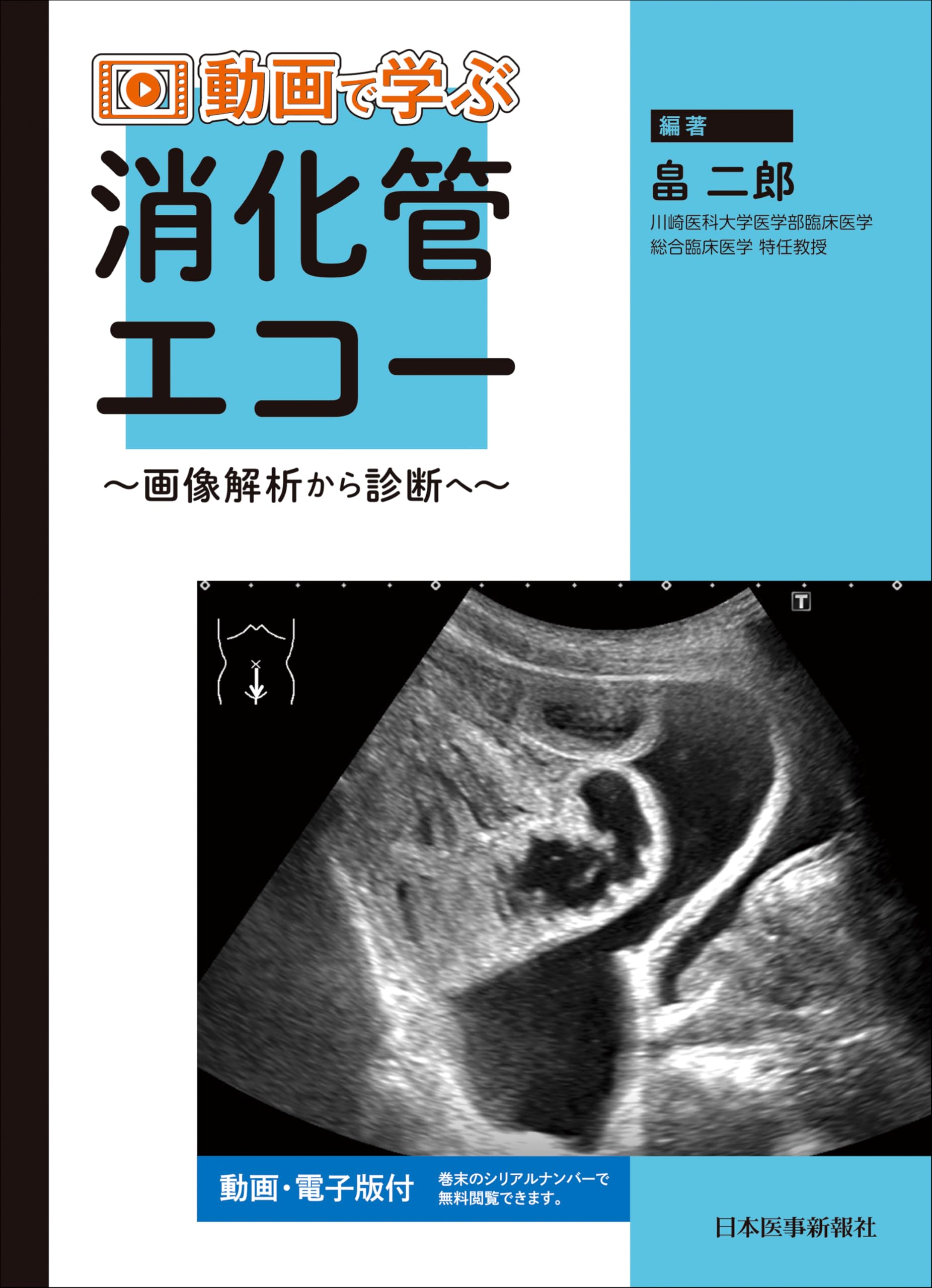 動画で学ぶ消化管エコー | 畠 二郎 |本 | 通販 | Amazon