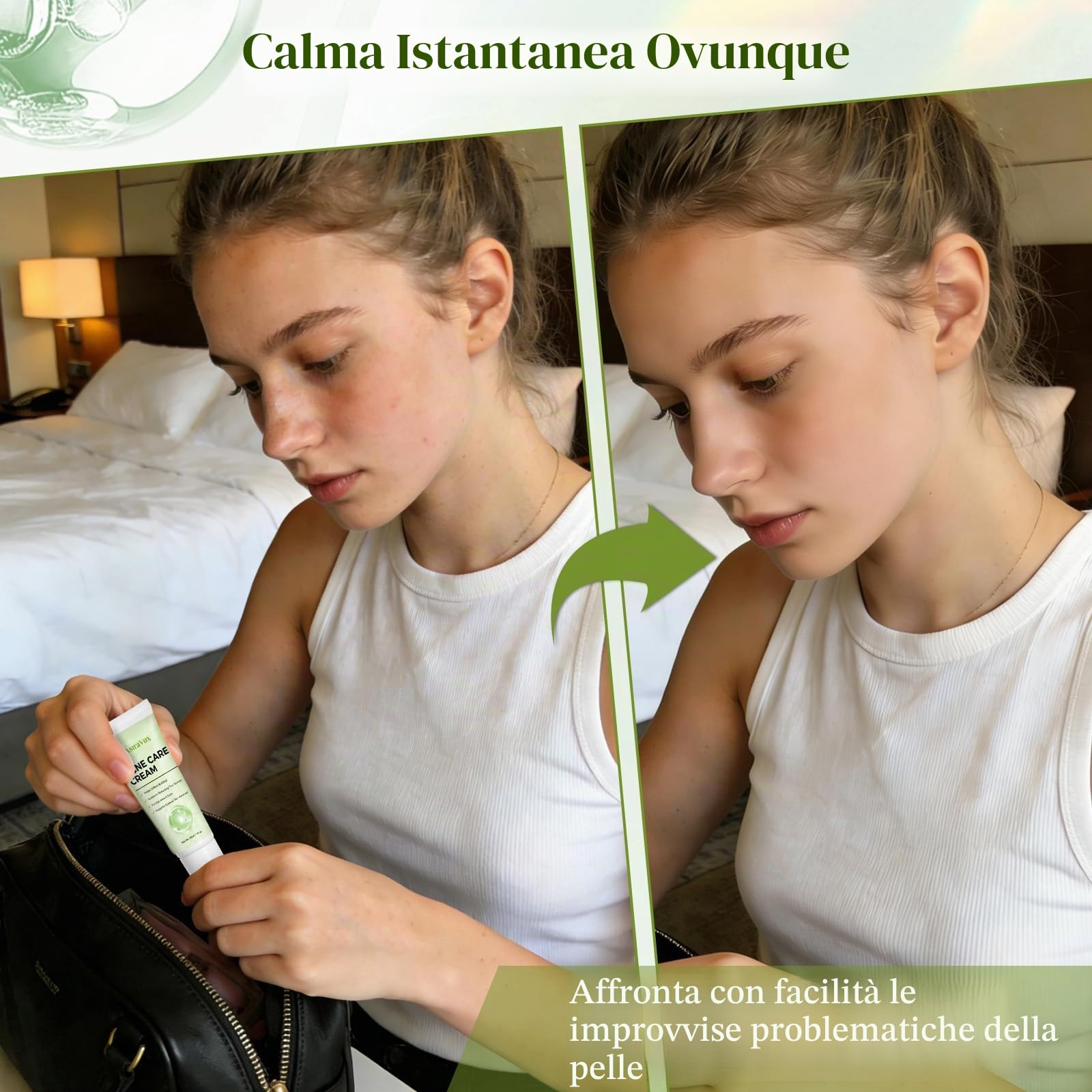 Crema Brufoli Viso, Crema Acne Potentissima, Combatte Efficacemente Acne, Brufoli e Punti Neri, Lenisce Rapidamente Gli Arrossamenti Cutanei, Adatto a Tutti i Tipi di Pelle, Ingredienti Delicati