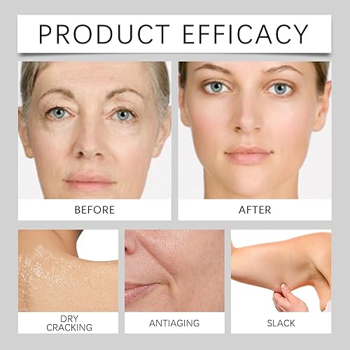 Miniatura 6 de Crema hidratante para rostro y cuerpo, hidratación profunda con glicerina y aceite mineral, absorción rápida para pieles sensibles secas, no grasosas