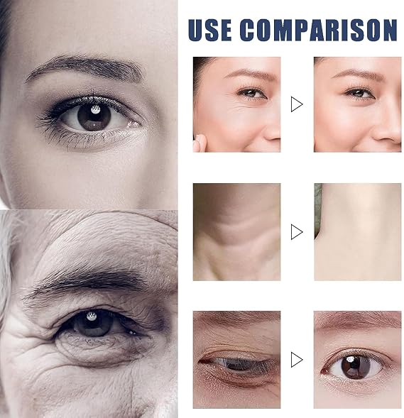 Japanese Qingling Wrinkle Removal Cream, Qingling Firming Anti-Aging Cream, Qingling Face Cream, Skin Care Facial Moisturizer Face Cream, for Tightening Sagging Skin Reduce Fine Lines (2Pcs, 50g)