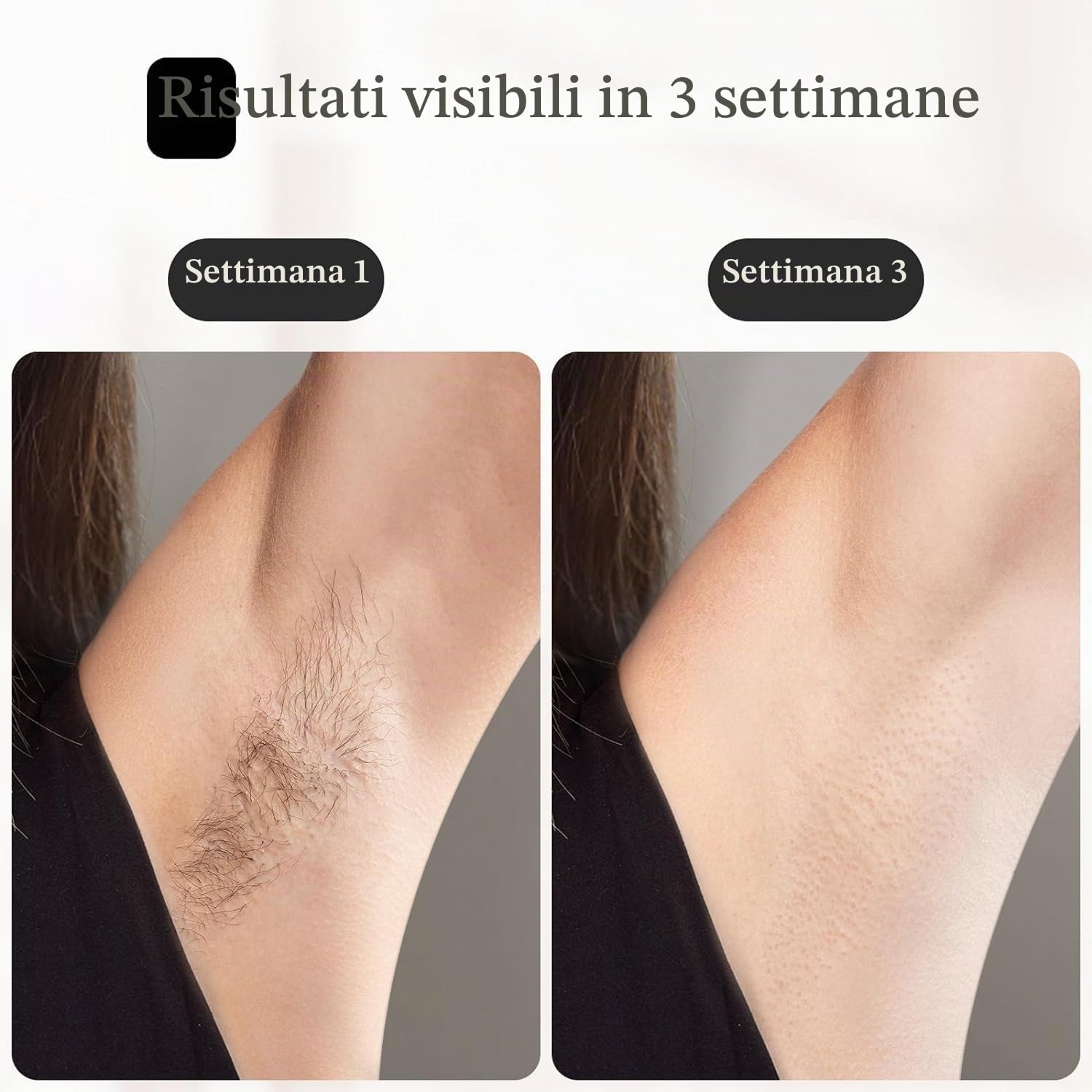 JOVS Depilazione laser, [24J Energy] Depilazione IPL per donne e uomini, tecnologia di raffreddamento del ghiaccio zaffiro indolore da 2,8 °C, 6 modalità per dispositivo di depilazione di tutto il