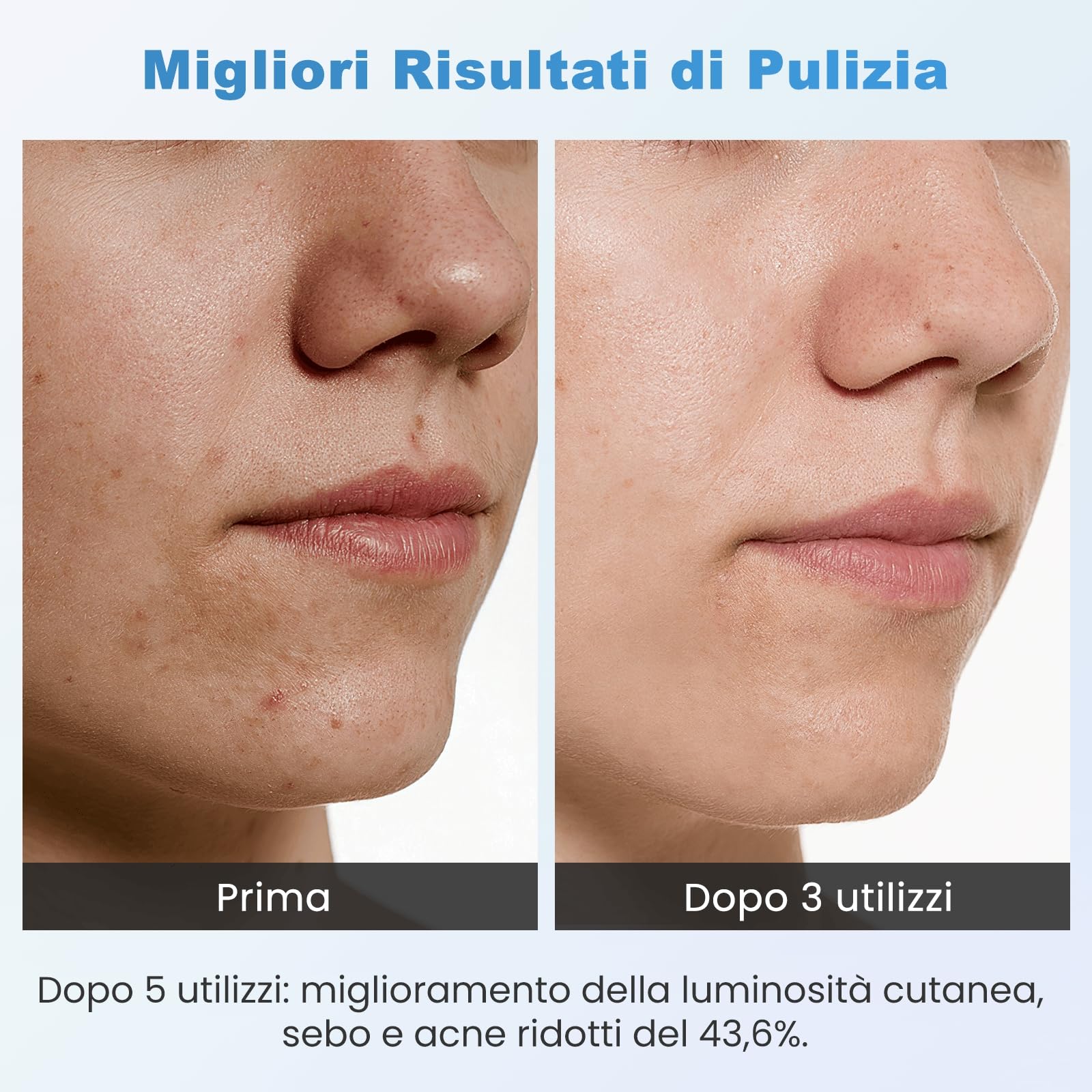 Aspiratore Punti Neri Professionale, Lrbsule Aspiratore Punti Neri Rimozione dei Grassi 6 Testine per Estrattore 3 Modalità di Aspirazione, Ricarica USB Blackhead Removal