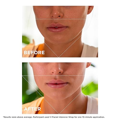 Miniatura 4 de Clarins Máscara facial intensiva V-Facial | Mascarilla de contorno facial galardonada | Reduce visiblemente la hinchazón y la hinchazón causadas por