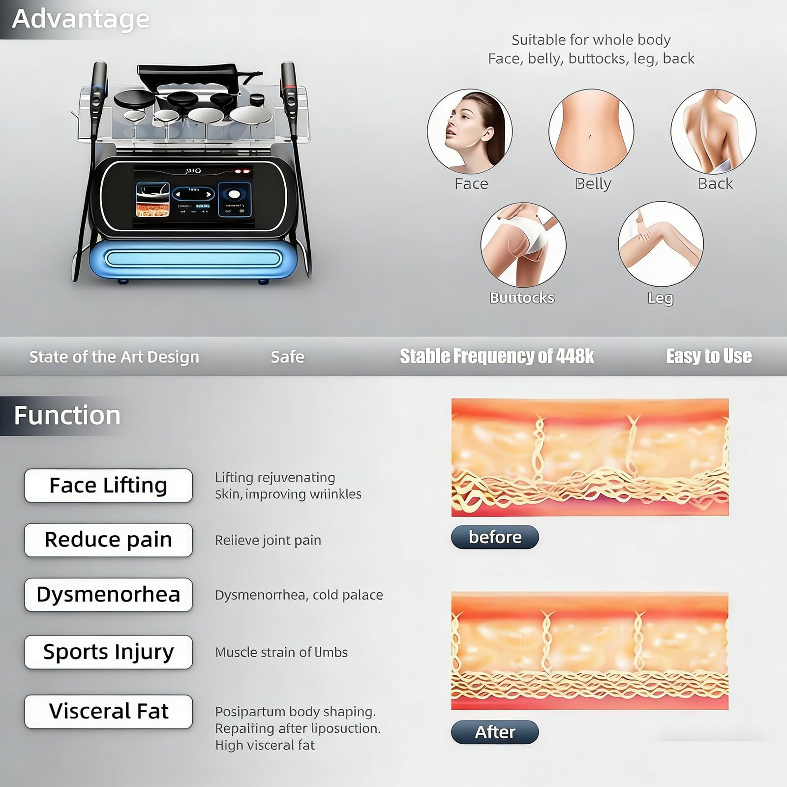 Macchina Gestione Dolore con Diatermia Fisioterapica Tecar Ret 448 Khz Cet, Macchina Tecar Intelligente per Fisioterapia, Sollievo dal Dolore Corporeo, Dimagrimento Corporeo/Lifting Viso