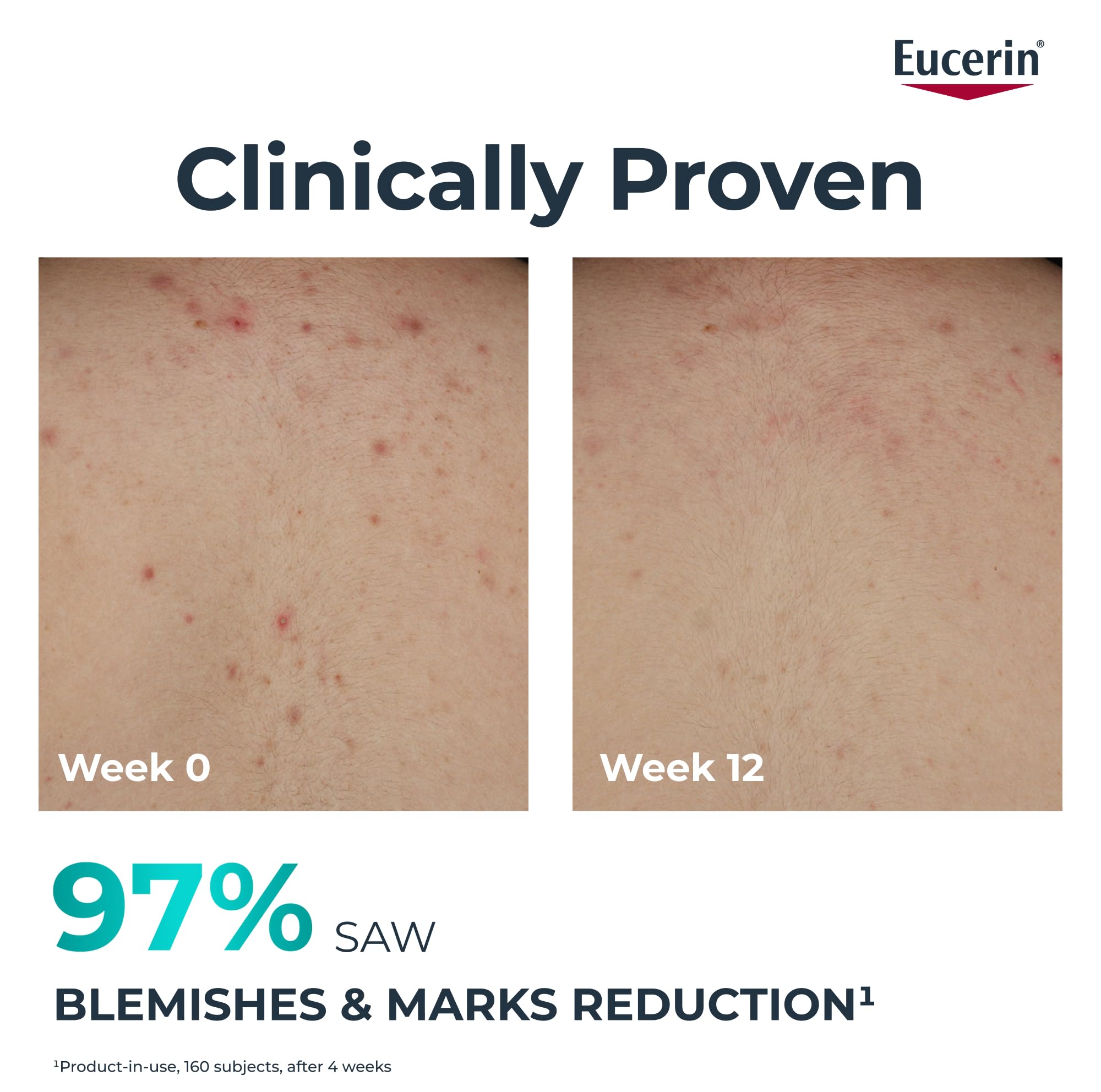 Eucerin DermoPure Clinical Correcting Body Care 200ml,Body Moisturiser with Salicylic Acid & Thiamidol,Reduces Blemishes & Acne Marks,Hydrating Moisturising Cream for Blemish-Prone Skin,Fast-Absorbing - Image 2