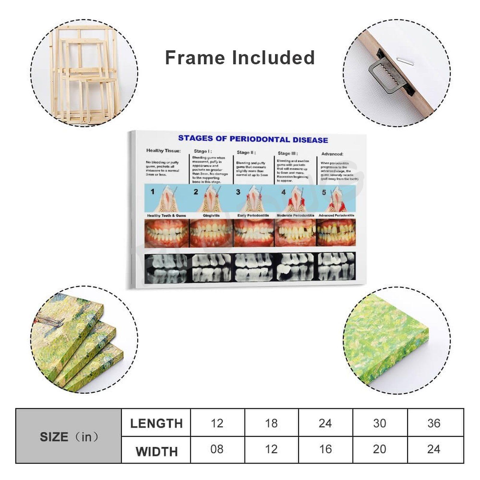 Magic Posters Anatomy Set Of 6 Patent Prints, Office Decor, Anatomical Muscle Poster, Clinic Wall Art, Medical Student Gifts For Doctors, Nurses, Surgeons