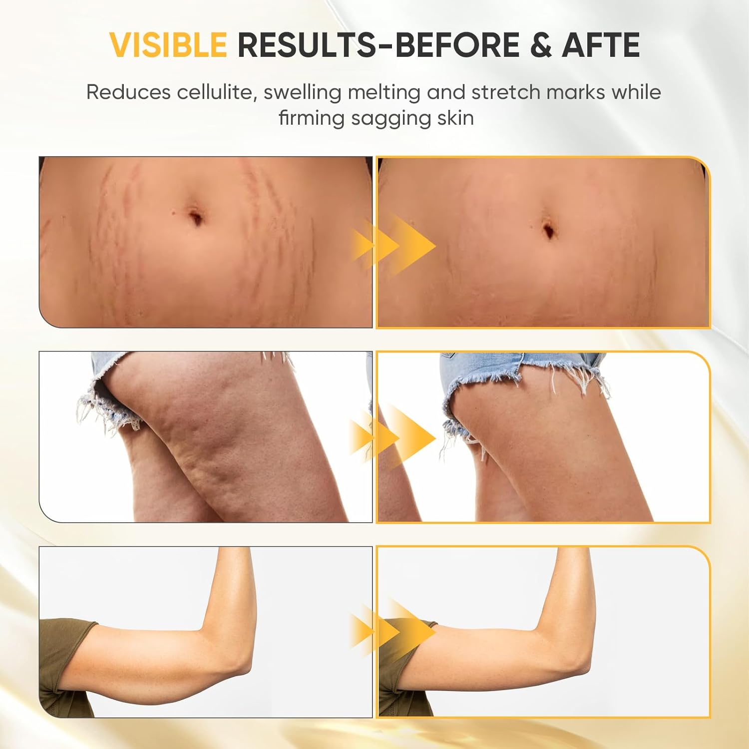 Lymphatic Drainage Massager - Anti Cellulite Massage Tool & Body Sculpting Machine with 30-Level Microcurrent, Light Heat & Vibration for Legs Arms & Belly Body Helps Reduce Stretch Marks & Cellulite - Image 6