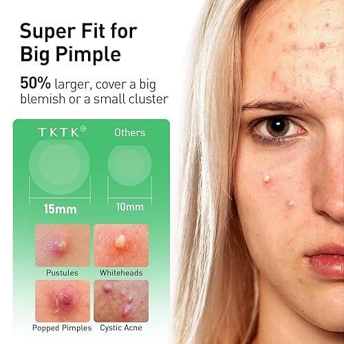 Miniatura 3 de TKTK Parches para espinillas  Parche invisible grande para acné de 0.591in para la cara con ácido salicílico, bordes extra finos de 0.0in para uso