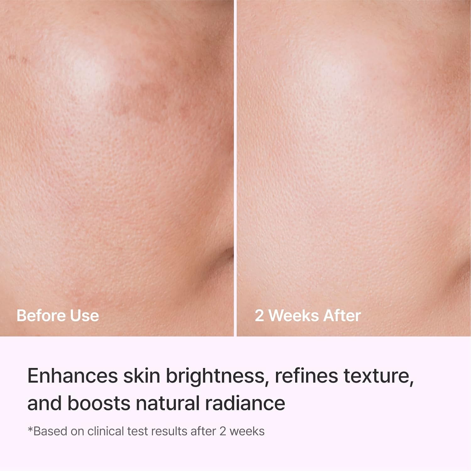 REJURAN® Triple Radiance Ampoule 50ml – DOT™ c-PDRN 0.5% Serum for Tone, Texture & Glow – Niacinamide & Licorice Extract for Even-Looking Skin