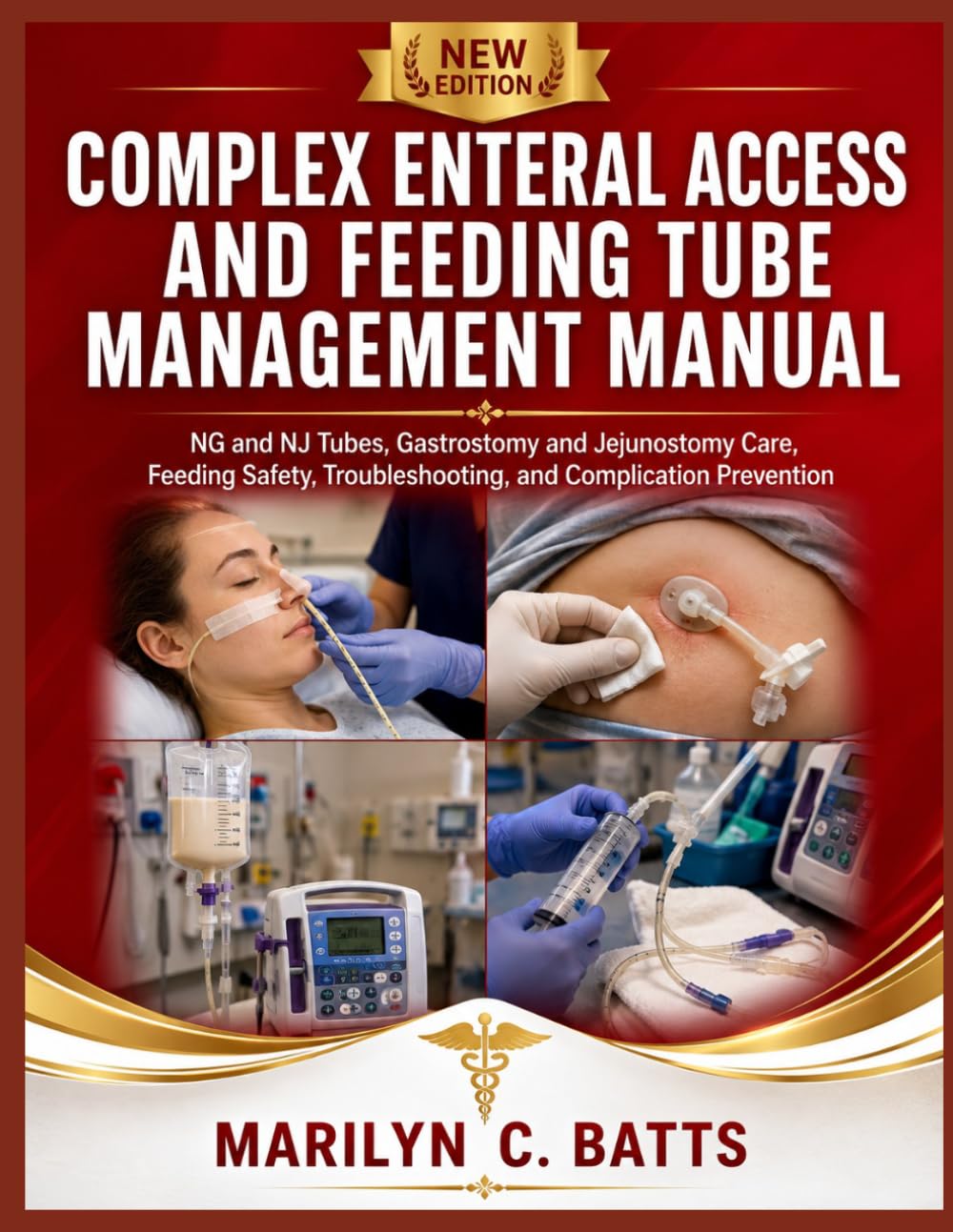 Complex Enteral Access and Feeding Tube Management Manual: NG and NJ Tubes, Gastrostomy and Jejunostomy Care, Feeding Safety, Troubleshooting, and Complication Prevention