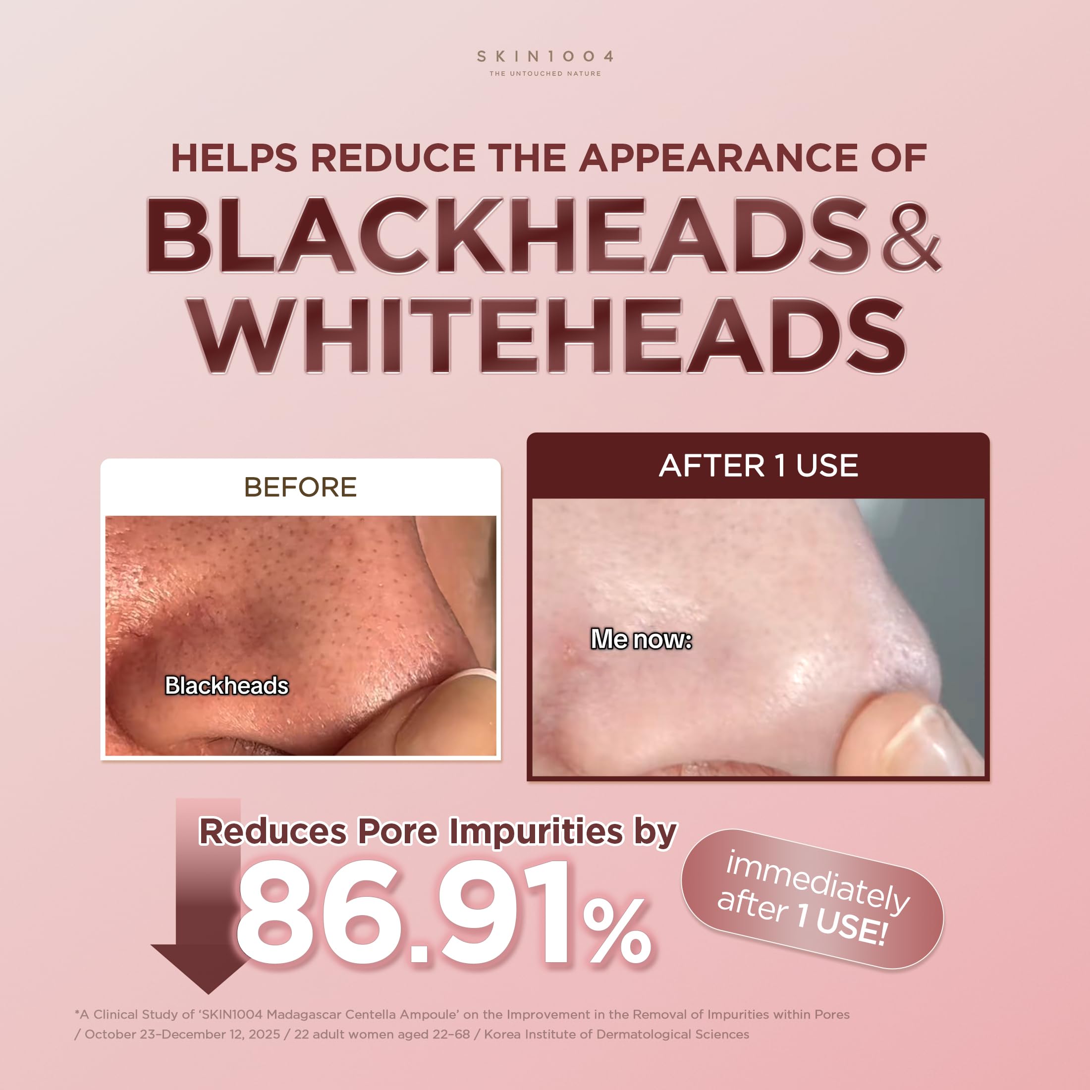 SKIN1004 Madagaskar Poremizing Centella Quick Clay maska oczyszczająca z glinki w sztyfcie 27 g