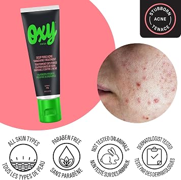 Oxy Acne Vanishing Treatment 0.10-Inches