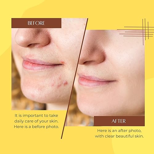 Miniatura 28 de Mamey Sapote Oil Aceite De Hueso De Mamey Humectante natural extra virgen prensado en frío para piel, cara, cuerpo y cabello Sin refinar, sin