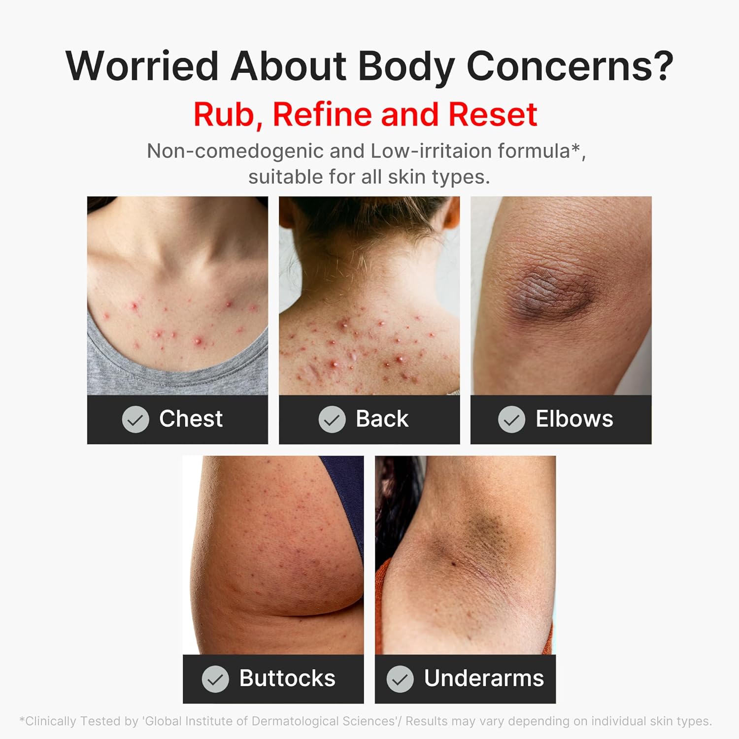 medicube Kojic Acid Turmeric Body Peel & Tone Duo: Turmeric Body Peel Shot and Kojic Acid Smoothing Toner | Gentle Exfoliation & Tone-Refining Care for Uneven Skin