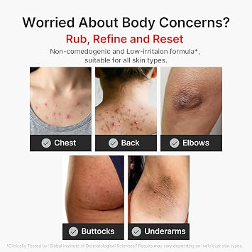 medicube Body Peel Shot with Kojic Acid and Turmeric | Gentle Body Brightening & Exfoliating with BHA LHA PHA - Dead Skin Cells, Uneven Looking Skin & Excess Sebum, 9.46 fl.oz