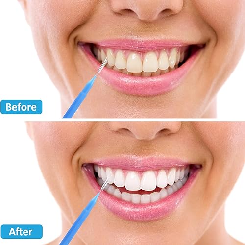 Miniatura 46 de Patelai 100 piezas de cepillos para limpiador, cepillo interdental, palillo de dientes, cabezal de hilo dental, hilo dental, higiene dental, hilo