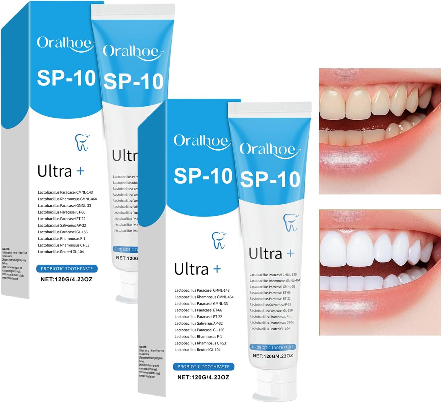 SP10 Probiotic Toothpaste Whitening Ultra+, 2026 New Deep
