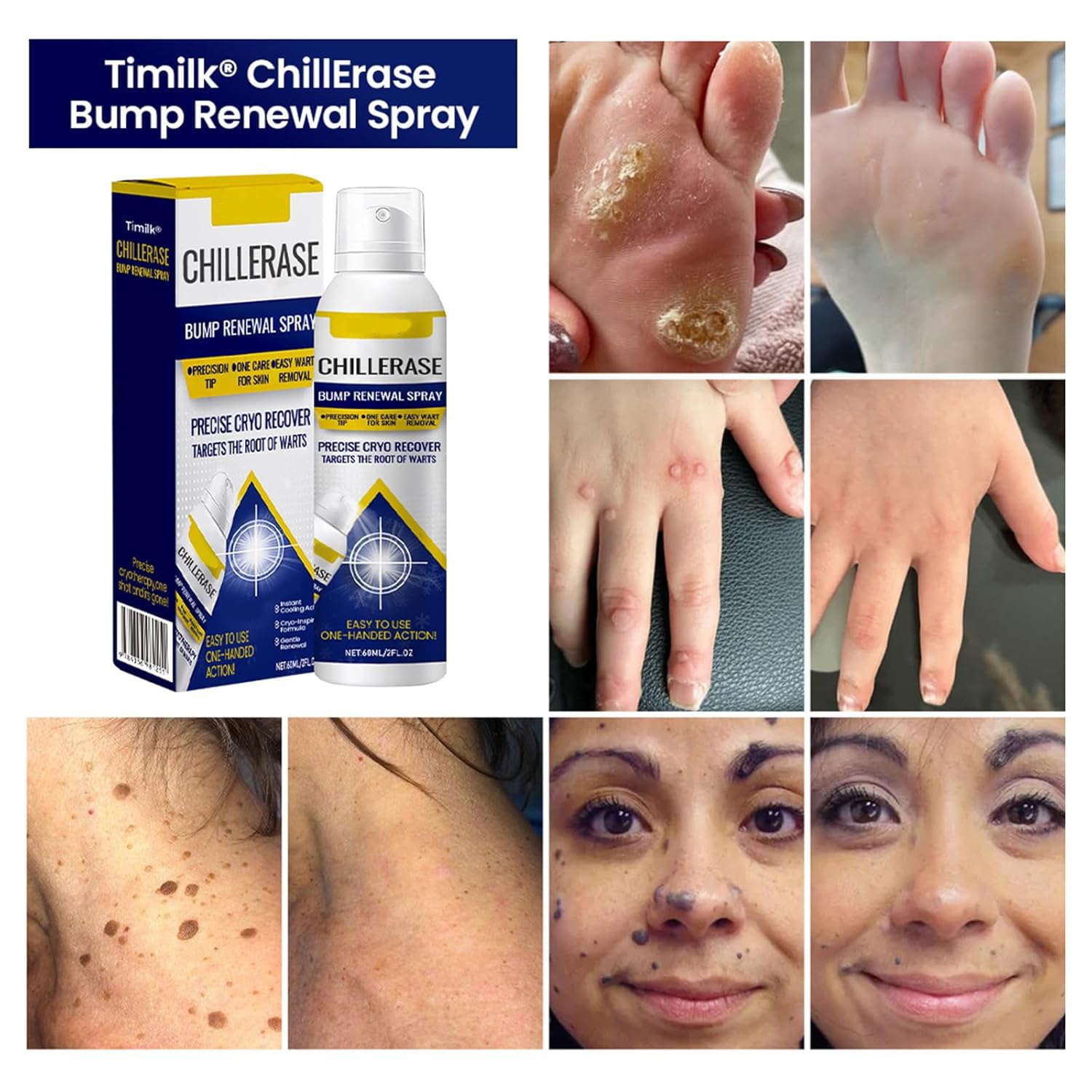 3pcs Chill Erase Bump Renewal Spray, Advanced Salicylic Acid Body Spray 2% & 2pcs Estrogen Cream for Hormone Balance, Natural Bioidentical Estrogen Cream for Women Menopause Relief (5 Bottle) - Image 3