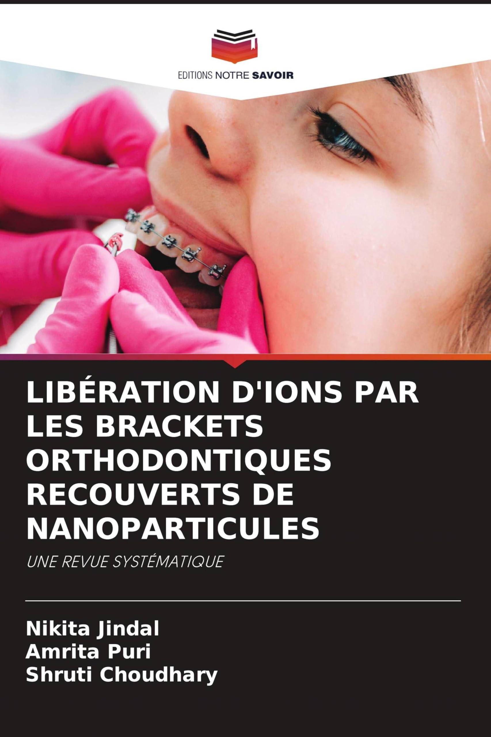 Libération d'Ions Par Les Brackets Orthodontiques Recouverts de Nanoparticules: UNE REVUE SYSTÉMATIQUE