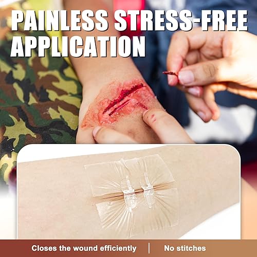 Miniatura 3 de Carbou Tiras de cierre de heridas de emergencia 4 piezas Bandaids de mariposa con puntada con cremallera Kit de cierre de laceración Sin