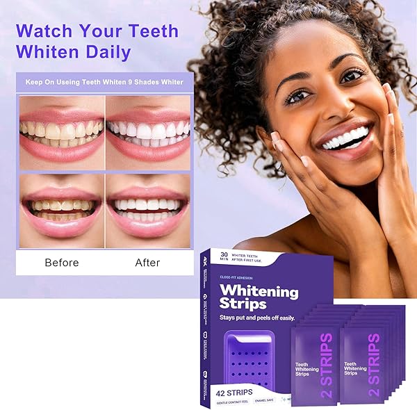 Générique Bande Blanchiment Dentaire Violet, Bandes Blanchissantes Dents Violettes, Teeth Whitening Strips, élimine Taches Café/Thé/Vin Blanchiment en toute sécurité sans dommage 2026 - 2