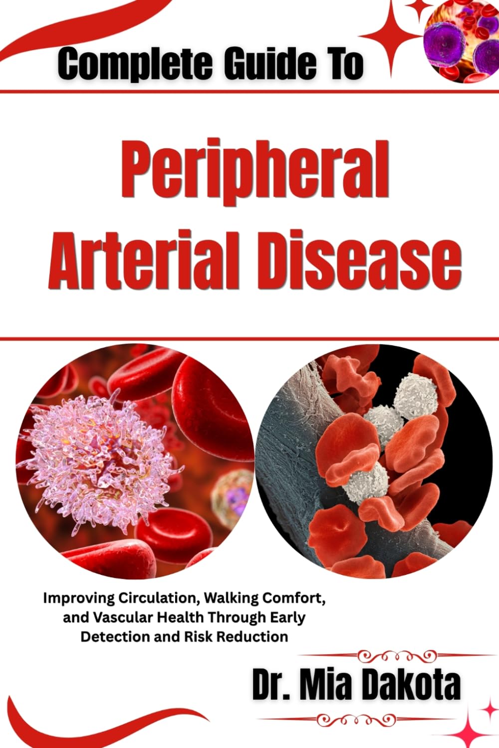 Complete Guide To Peripheral Arterial Disease: Improving Circulation, Walking Comfort, and Vascular Health Through Early Detection and Risk Reduction